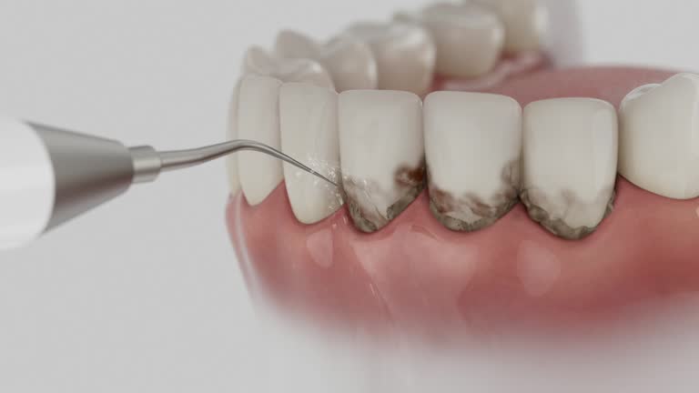 Reliable Dental Implants contractor in Natalia, TX by Smile Center Dentistry